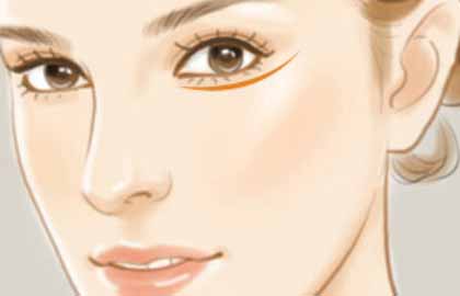 重慶肋骨隆鼻多少錢(qián)