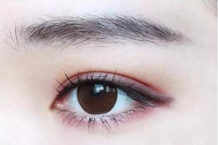 歐式雙眼皮多少錢