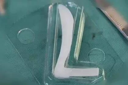 鄭州美萊整形專家水平怎么樣?面部一枝花全靠鼻當(dāng)家