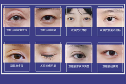 鄭州美萊整形眼修復(fù)多少錢?