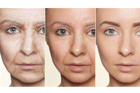 <a href='/zz/' target='_blank'><u>鄭州美萊</u></a>整形法令紋怎么祛除?