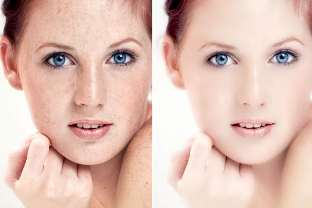 <a href='/zz/' target='_blank'><u>鄭州美萊</u></a>四維一體聯(lián)合祛斑，一站式解鎖祛斑難題