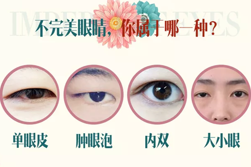 <a href='/zz/' target='_blank'><u>鄭州美萊</u></a>做雙眼皮的誤區(qū)你知道嗎?