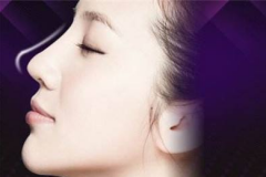 鄭州美萊玻尿酸隆鼻怎么樣？