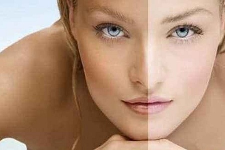 福州美萊彩光嫩膚效果怎么樣