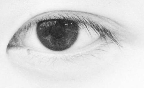 上海美萊眼綜合術(shù)能打造哪些眼型？