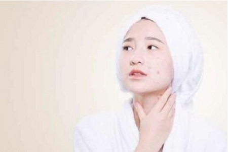 成都點(diǎn)陣激光價(jià)錢(qián) 你也可以很精致