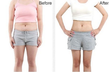 昆明自體脂肪多少錢(qián) 減肥變得輕而易舉