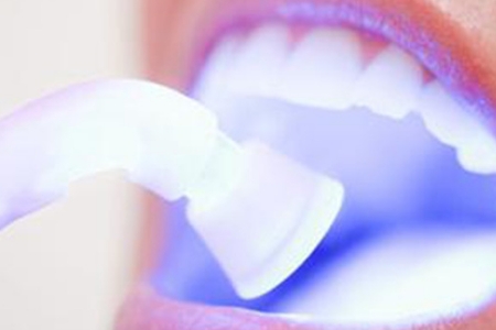 牙齒黃，做佛山牙齒美白維持多久