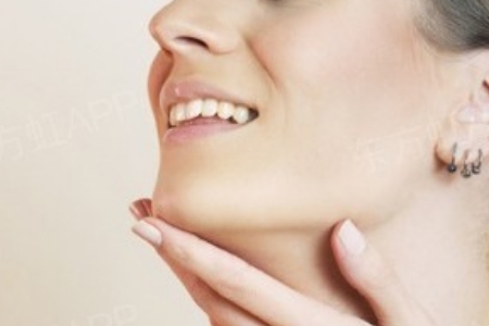 曲靖改臉型多少錢？影響因素有哪些