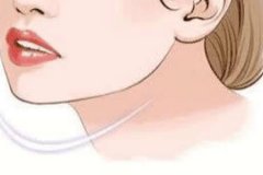 國字臉如何變成瓜子臉，瘦臉方法分享