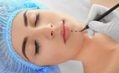 假體墊下巴可以管一輩子嗎，2023豐下巴價(jià)格表