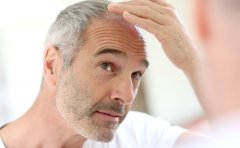 種植發(fā)際線一般多少錢啊，2023植發(fā)一覽價(jià)格表