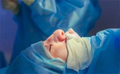 隆鼻失敗修復整形的價格，醫(yī)院排名前三美萊、紫馨、華美資料分享