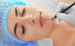 假體墊下巴大概需要多少錢，貴陽、寧波、福州價格參考