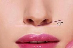 鼻翼縮小手術有風險嗎，術后需要注意什么