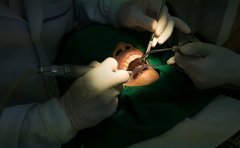 上海做美容冠矯正牙齒價(jià)格多少錢，需要多長時(shí)間