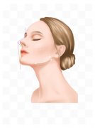 廣州醫(yī)院做下頜角截骨手術一般多少錢，會有后遺癥嗎