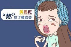 激光真的能去黃褐斑嗎，祛斑價格是多少