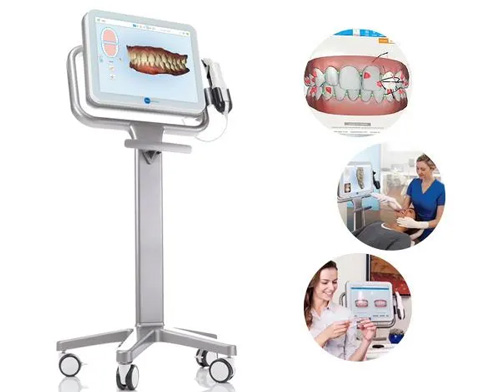 美萊隆重推出雙旦福利，報(bào)名體驗(yàn)牙齒矯正黑科技iTero 口掃