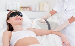 激光脫手臂毛要多少錢，附脫毛費(fèi)用一覽表