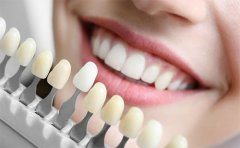 美白牙齒的價格是多少錢啊，廣州、深圳、天津價格一覽表