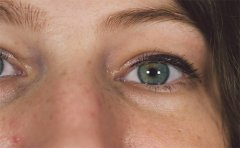 超聲波去眼袋效果好嗎，貴陽、寧波、石家莊費(fèi)用參考