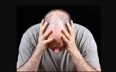 毛發(fā)種植費用是多少，有哪些因素會影響價格