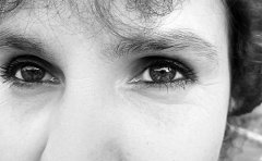 祛魚尾紋的操作方法以及術后護理