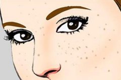 蘇州祛斑醫(yī)院激光治療一次多少錢，多久能恢復(fù)正常