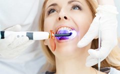 冷光美白牙齒需要做幾次，效果自然嗎，附美白價(jià)格表